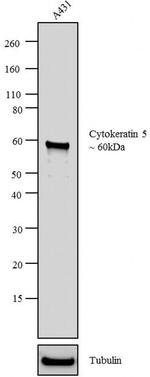 Cytokeratin 5 Antibody in Western Blot (WB)