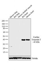 Cardiac Troponin T Antibody