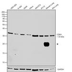 CDK4 Antibody in Western Blot (WB)