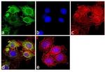 Cytokeratin Pan Type I Antibody in Immunocytochemistry (ICC/IF)