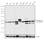 Cytokeratin Pan Type I Antibody in Western Blot (WB)