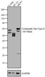 Cytokeratin Pan Type II Antibody in Western Blot (WB)