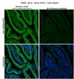 Cytokeratin Pan Type I/II Antibody in Immunohistochemistry (Paraffin) (IHC (P))