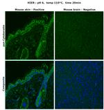 Cytokeratin Pan Type I/II Antibody in Immunohistochemistry (Paraffin) (IHC (P))