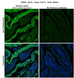 Cytokeratin Pan Antibody in Immunohistochemistry (Paraffin) (IHC (P))