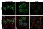 SNRPB Antibody in Immunocytochemistry (ICC/IF)