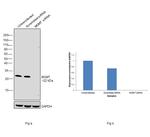 MGMT Antibody in Western Blot (WB)