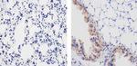 MMP2 Antibody in Immunohistochemistry (Paraffin) (IHC (P))