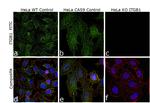 ITGB1 Antibody in Immunocytochemistry (ICC/IF)