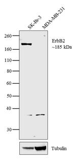 ErbB2 (HER-2) Antibody