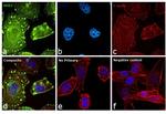 ErbB2 (HER-2) Antibody