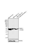 TIMP1 Antibody in Western Blot (WB)