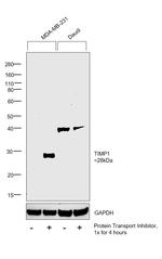 TIMP1 Antibody in Western Blot (WB)