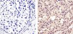 p53 Antibody in Immunohistochemistry (Paraffin) (IHC (P))