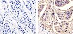 MUC1 Antibody in Immunohistochemistry (Paraffin) (IHC (P))