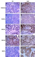 FANCD2 Antibody in Immunohistochemistry (IHC)