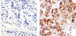 E-cadherin Antibody in Immunohistochemistry (Paraffin) (IHC (P))