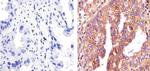 E-cadherin Antibody in Immunohistochemistry (Paraffin) (IHC (P))