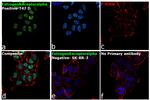 Estrogen Receptor alpha Antibody