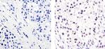 Progesterone Receptor Antibody in Immunohistochemistry (Paraffin) (IHC (P))