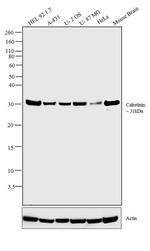 Calretinin Antibody in Western Blot (WB)