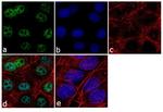 VDR Antibody in Immunocytochemistry (ICC/IF)