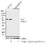 AFP Antibody