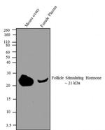 Follicle Stimulating Hormone Antibody in Western Blot (WB)