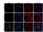 CRP Antibody