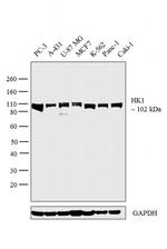 HK1 Antibody in Western Blot (WB)