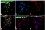 Progesterone Receptor Antibody