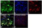 Lyn Antibody in Immunocytochemistry (ICC/IF)