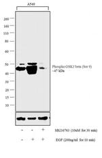 Phospho-GSK3B (Ser9) Antibody