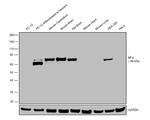 NEFL Antibody in Western Blot (WB)