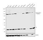 Catenin alpha-1 Antibody in Western Blot (WB)