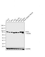 GYS1 Antibody in Western Blot (WB)