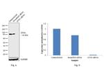 GYS1 Antibody in Western Blot (WB)