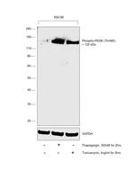 Phospho-PERK (Thr980) Antibody