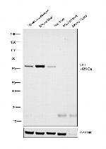 NEFL Antibody in Western Blot (WB)