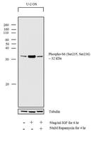 Phospho-S6 (Ser235, Ser236) Antibody