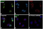 Zap-70 Antibody in Immunocytochemistry (ICC/IF)