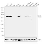 Zap-70 Antibody in Western Blot (WB)