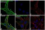 Phospho-PDGFRB (Tyr751) Antibody in Immunocytochemistry (ICC/IF)