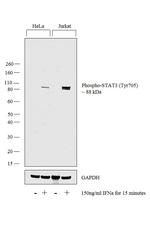 Phospho-STAT3 (Tyr705) Antibody