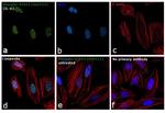 Phospho-STAT3 (Ser727) Antibody