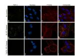 FGF2 Antibody in Immunocytochemistry (ICC/IF)