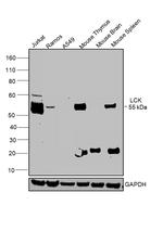 LCK Antibody in Western Blot (WB)