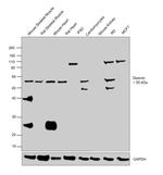 Desmin Antibody in Western Blot (WB)