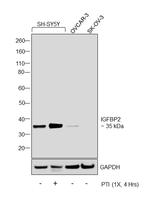 IGFBP2 Antibody in Western Blot (WB)