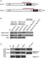 ETV1 Antibody in Western Blot (WB)